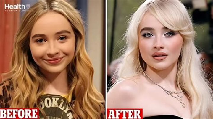 Sabrina Carpenter's Plastic Surgery: Before And After