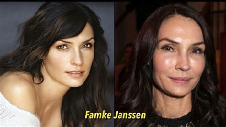 Unveiling The Truth Behind Famke Janssen Surgery